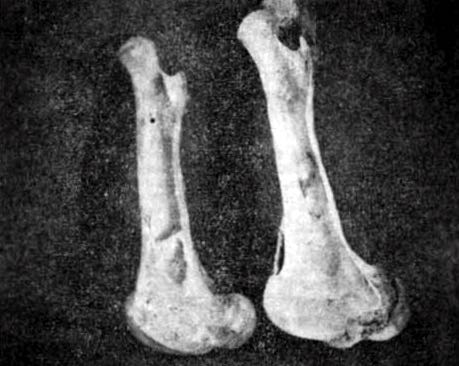 image of abnormal cattle bones