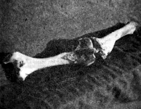 image of abnormal cattle bones