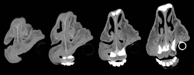 Cross-sectional image of sheep nose showing narrowed lumen
