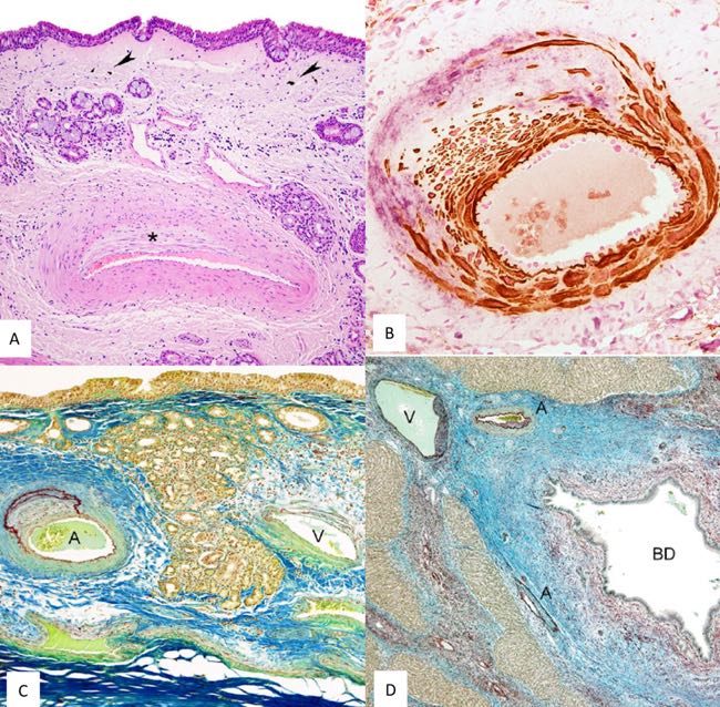 Photomicrographs of ovine nasal tissues showing abnormalities on histology and immunohistochemistry
