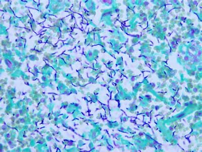 Microscopic image of anthrax organisms