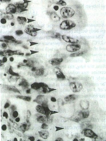 Photomicrograph of sheep intestine