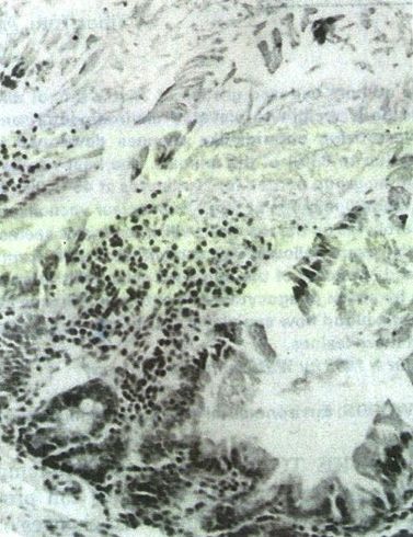 Photomicrograph of sheep intestine