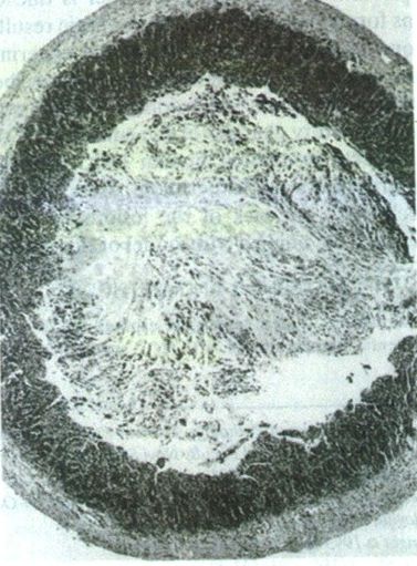 Photomicrograph of sheep intestine