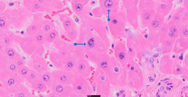 Photomicrograph of bovine liver showing anisocytosis and anisokaryosis