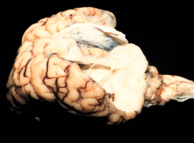 Image of calf brain post-mortem showing small cortex and cerebellum