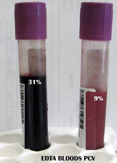 Image of EDTA bloods