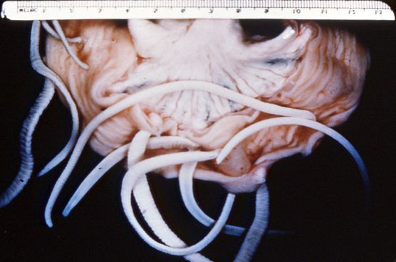 Microscopic image of worm