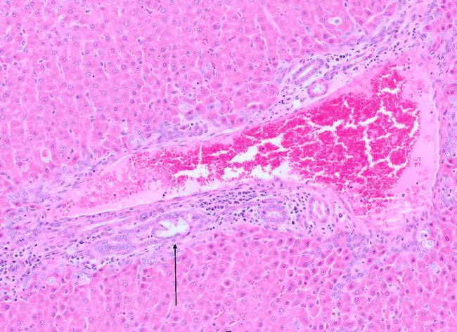 Photomicrograph of lamb bile duct showing crystal ghost